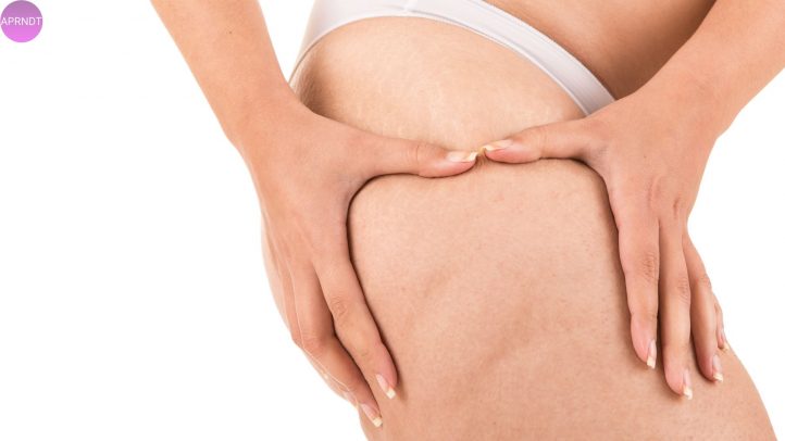 celulitis infecciosa