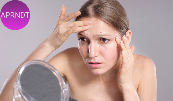 De qué se trata el estrés en la piel