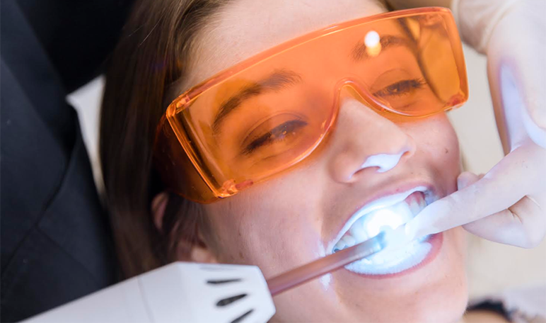 Blanqueamiento dental con láser: proceso y beneficios - Apréndete